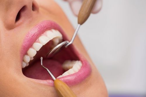 Рейтинг ТОП 3 стоматологических апекслокаторов: обзоры, особенности оборудования