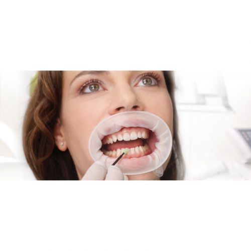 Безлатексный ретрактор губ и щек OptraGate Refill (набор)